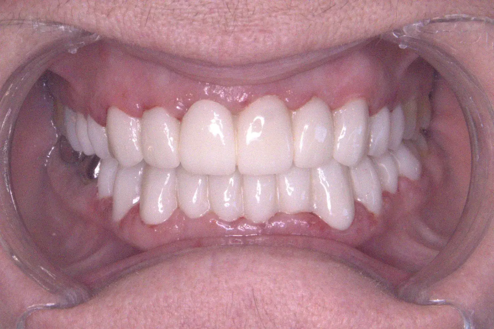 Anda Gaicha – After