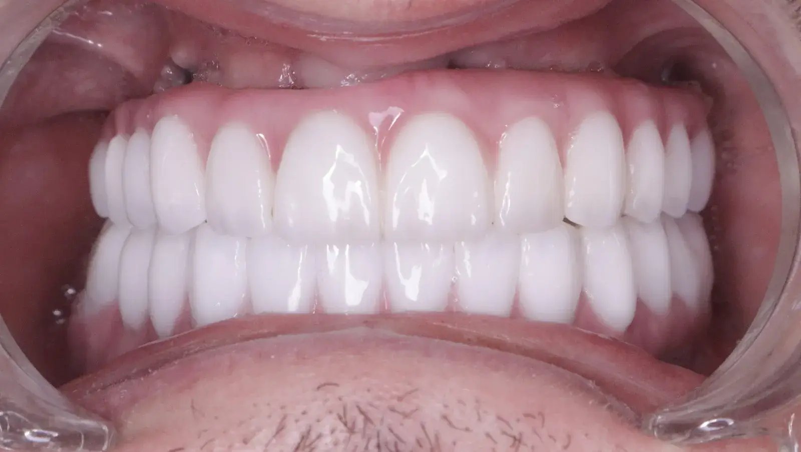 Martins Tint – After