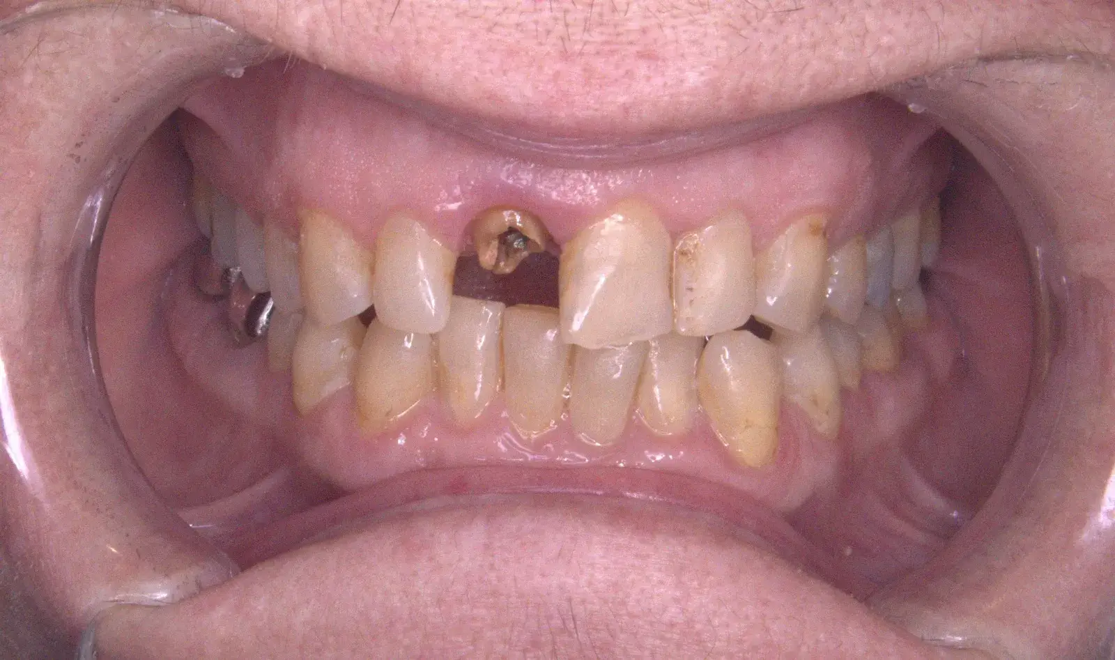 Anda Gaicha – Before