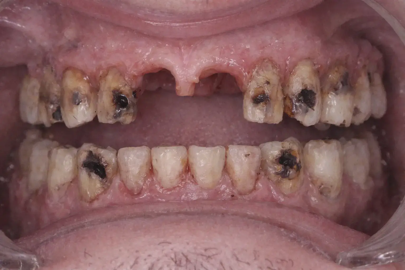 Martins Tint – Before