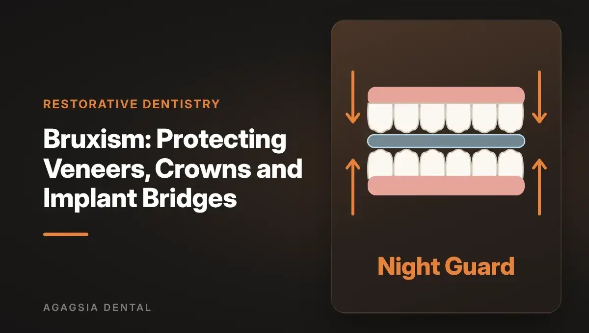 Bruxism: Protecting Veneers, Crowns and Implant Bridges