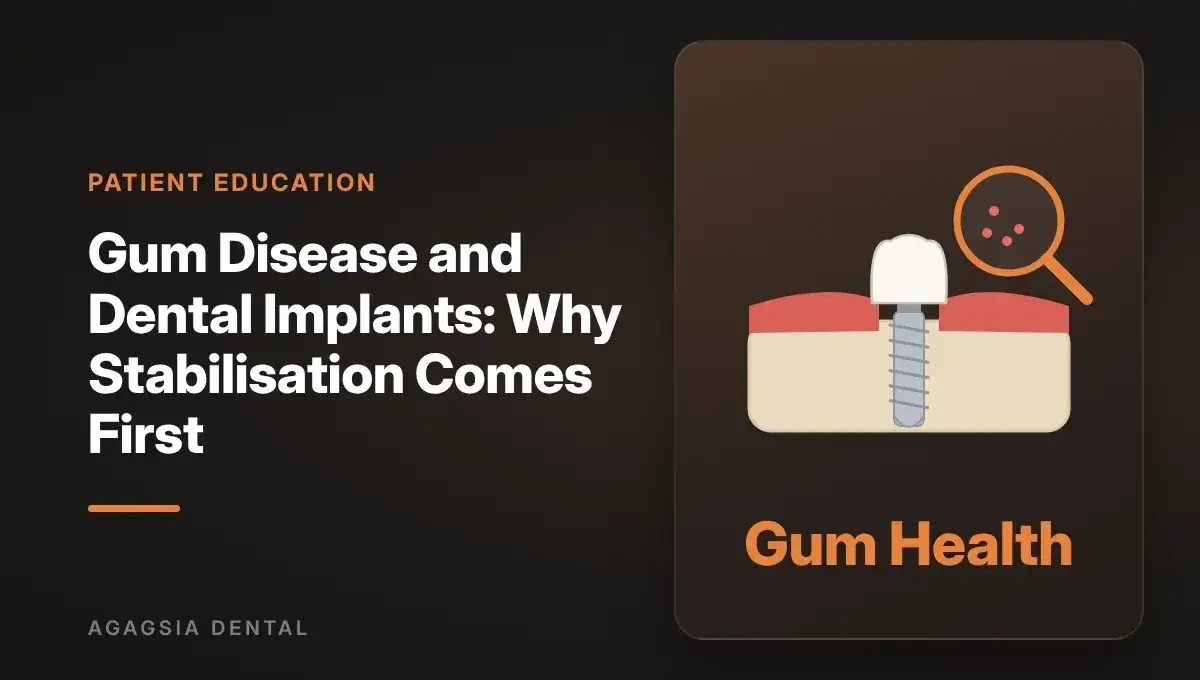 Gum Disease and Dental Implants: Why Stabilisation Comes First