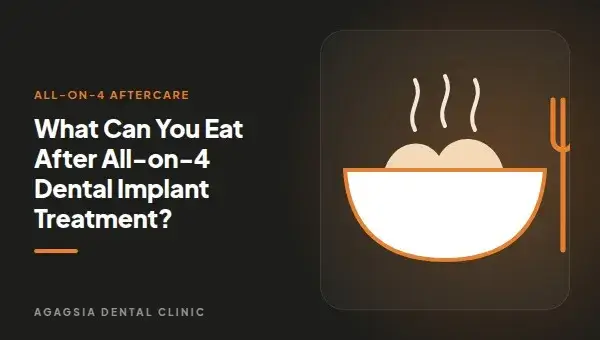 What Can You Eat After All-on-4 Dental Implant Treatment?