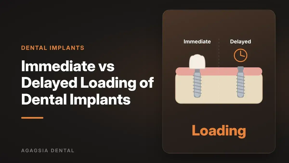 Immediate Loading vs Delayed Loading of Dental Implants