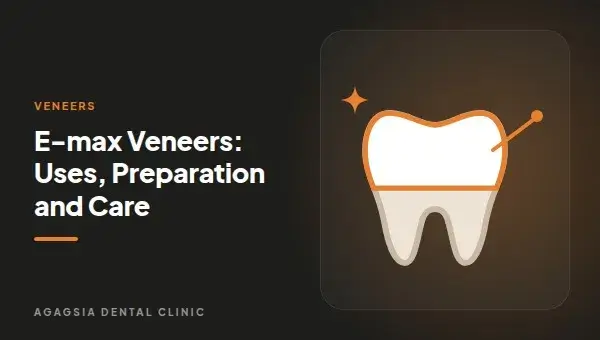 E-max Veneers: Uses, Preparation and Care