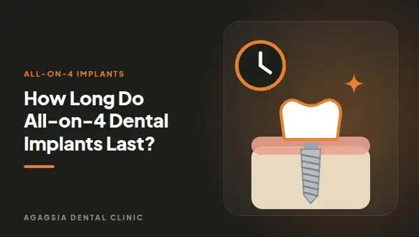 How Long Do All-on-4 Dental Implants Last?