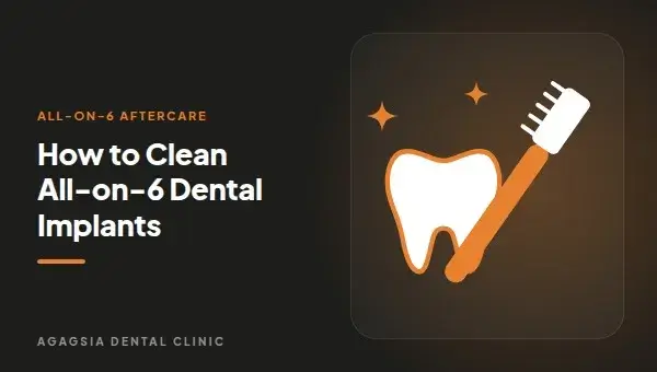How to Clean All-on-6 Dental Implants
