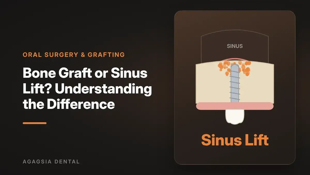 Bone Graft or Sinus Lift? Understanding the Difference