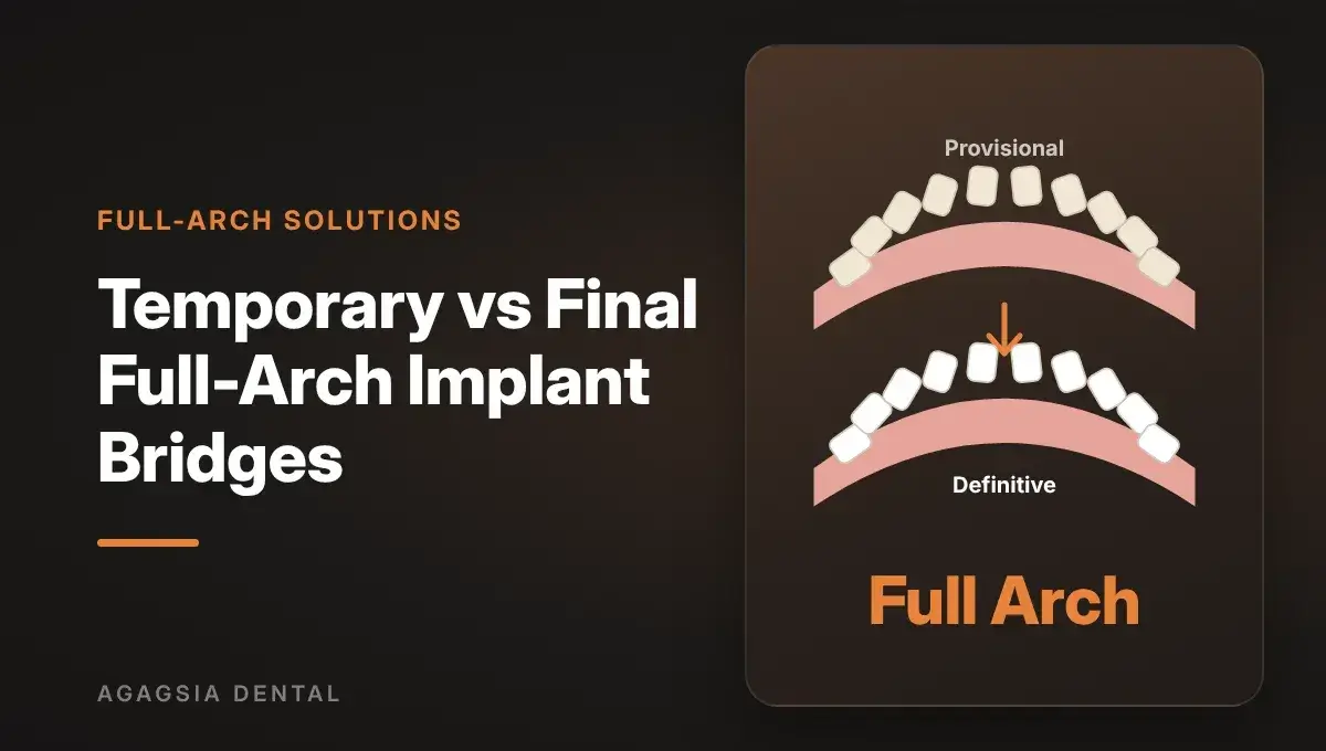 Temporary vs Final Full-Arch Implant Bridges