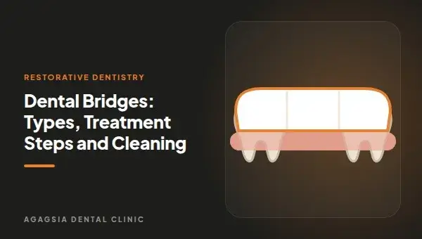 Dental Bridges: Types, Treatment Steps and Cleaning