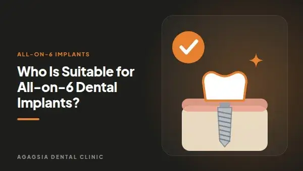 Who Is Suitable for All-on-6 Dental Implants?